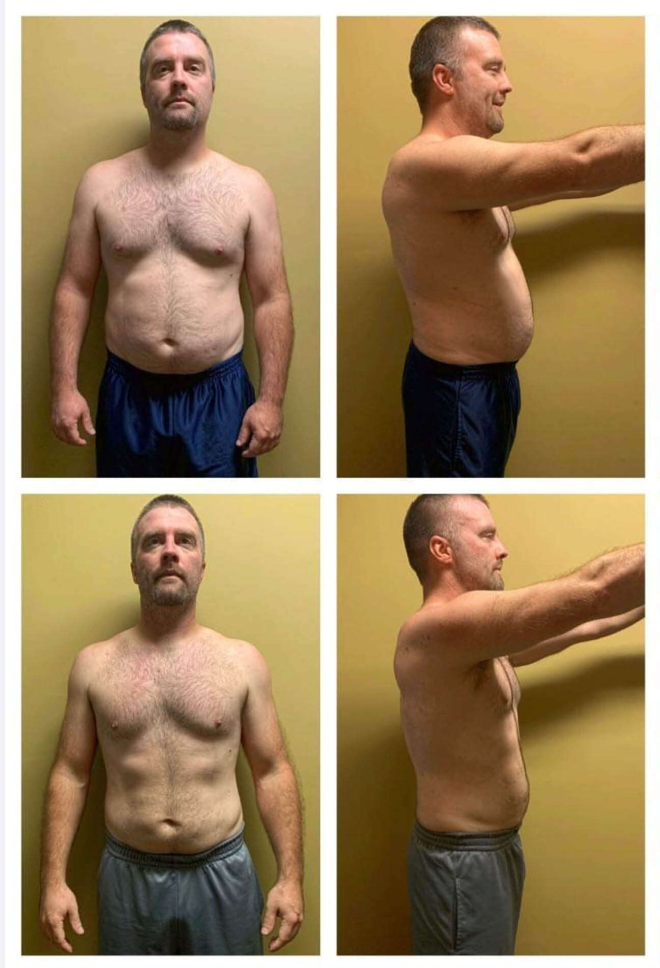 A man is shown in two sets of photos taken from the front and side. In the first set, he has a larger belly. In the second set, his belly is slimmer. He is wearing dark shorts and is standing against a tan wall.